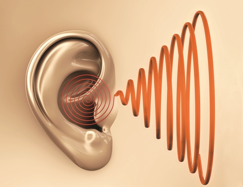 Tinnitus
